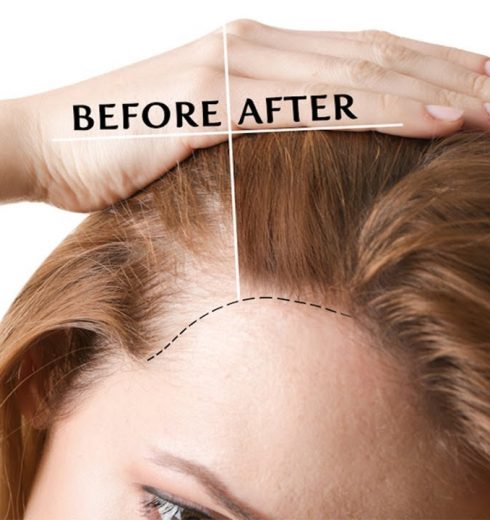 How To Thicken Hair Naturally 5 Ways| Proven Home Remedies