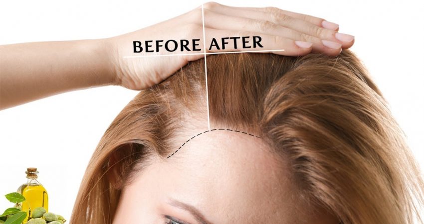 How To Thicken Hair Naturally 5 Ways| Proven Home Remedies