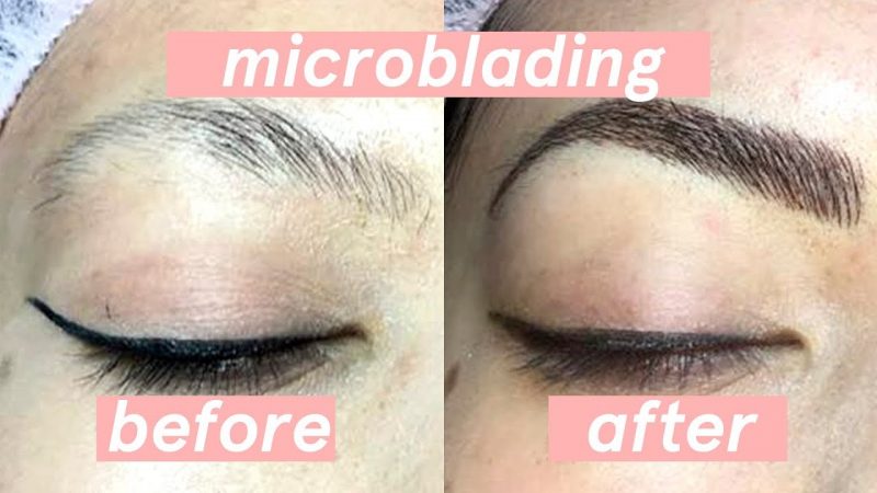 Microblading