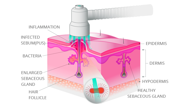 How-does-red-light-therapy-work